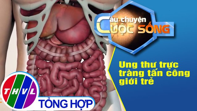 Ung thư trực tràng tấn công giới trẻ