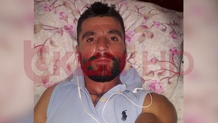 30-vjeçarja vritet me shkop druri nga kunati