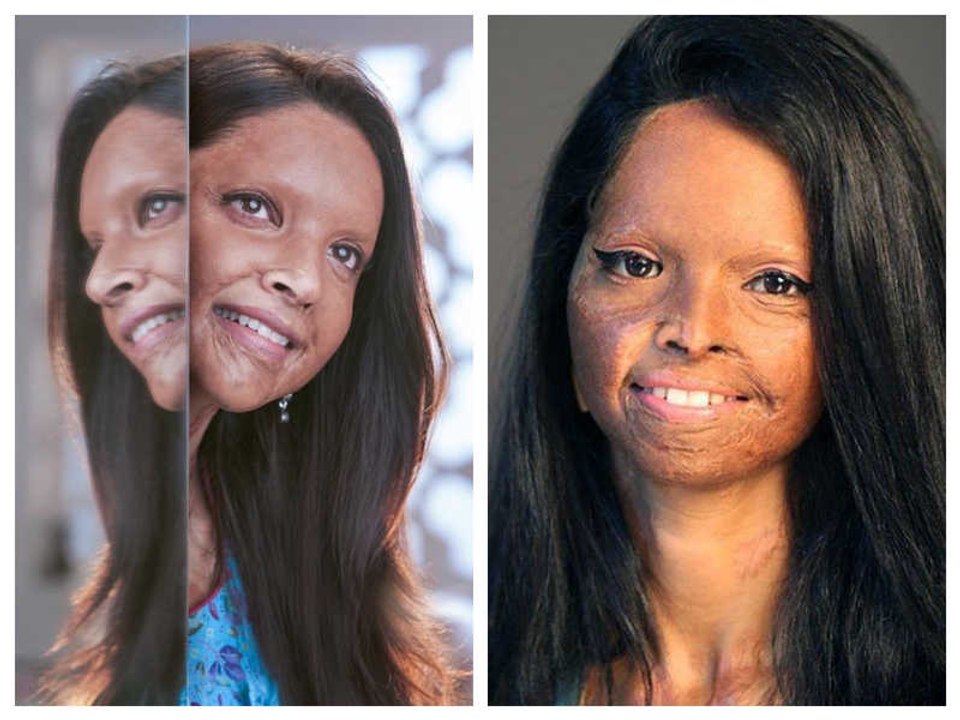 Chhapaak Original Girl Laxmi Agarwal Life Story | Boldsky Kannada