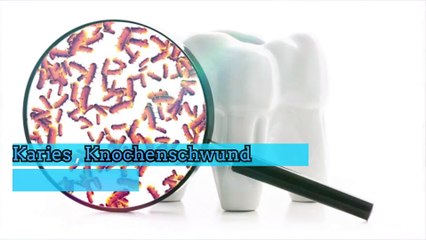 Sind E-Zigaretten schlecht für die Zähne?