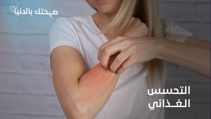 التحسس الغذائي.. أنواعه وأعراضه وأبرز الأغذية المسببة له
