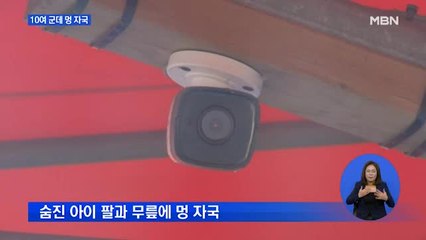 10여 군데 멍 자국…찬물 학대로 숨진 아동 추가 학대 가능성