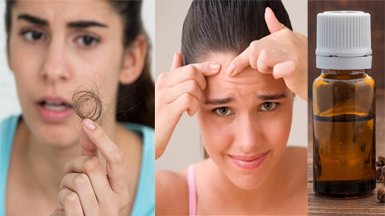 लौंग के तेल के जादुई फायदे Clove Oil Benefits in HindiClove Oil