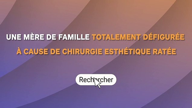 Une mère de famille totalement métamorphosée à cause de chirurgie esthétique ratée