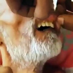 Man's mouth full of wolves, going to surgery.(Adamın ağzı kurt dolmuş, Ameliyat olucak)