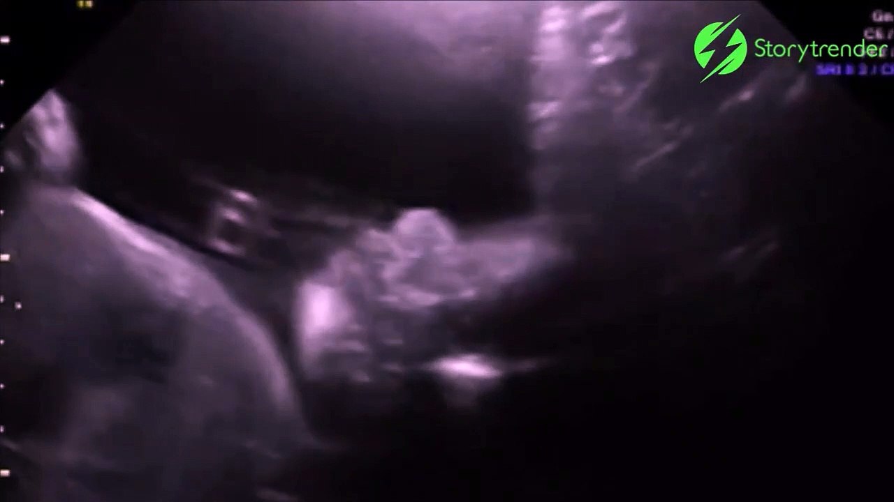 Dans le ventre de maman, ce bébé fait coucou