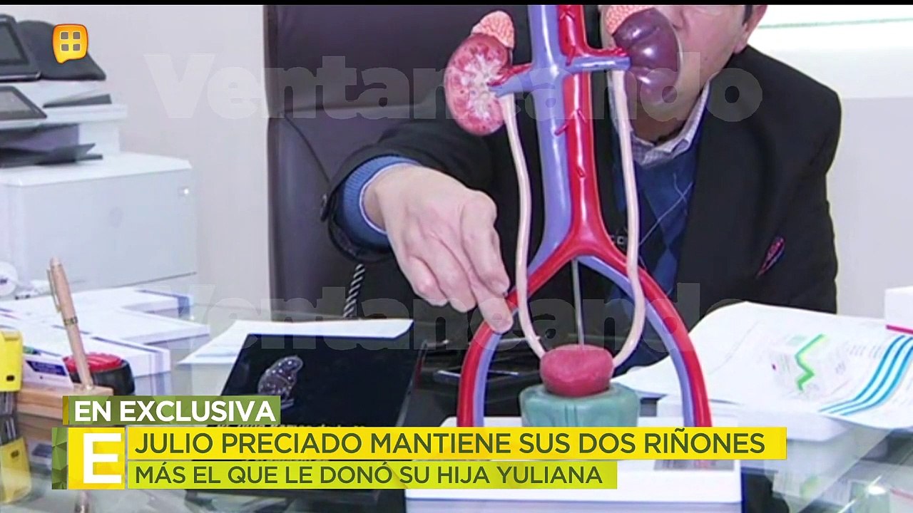¡Julio Preciado tiene ahora tres riñones! Su nefrólogo detalla cómo es esto posible. | Ventaneando