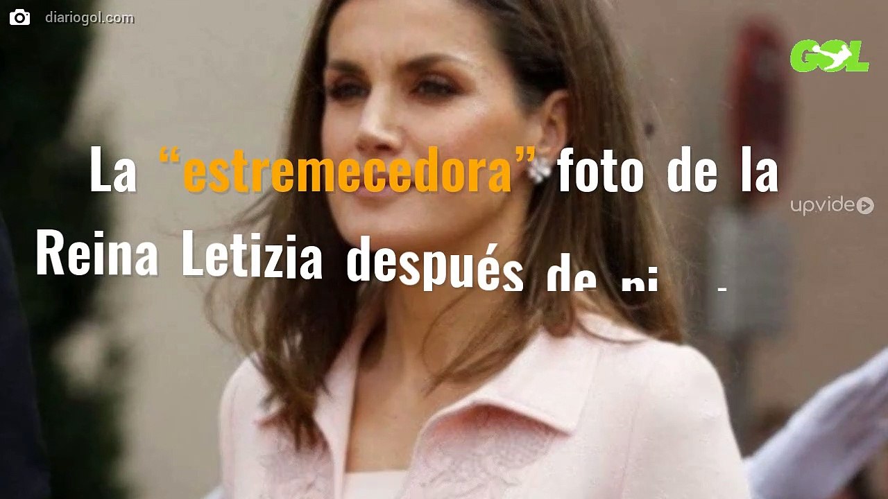 La “estremecedora” foto de la Reina Letizia después de pincharse bótox