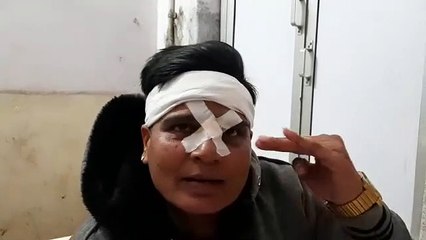 चाइना डोर से पुलिसकर्मी घायल, आंख नाक के पास गहरी चोट लगी