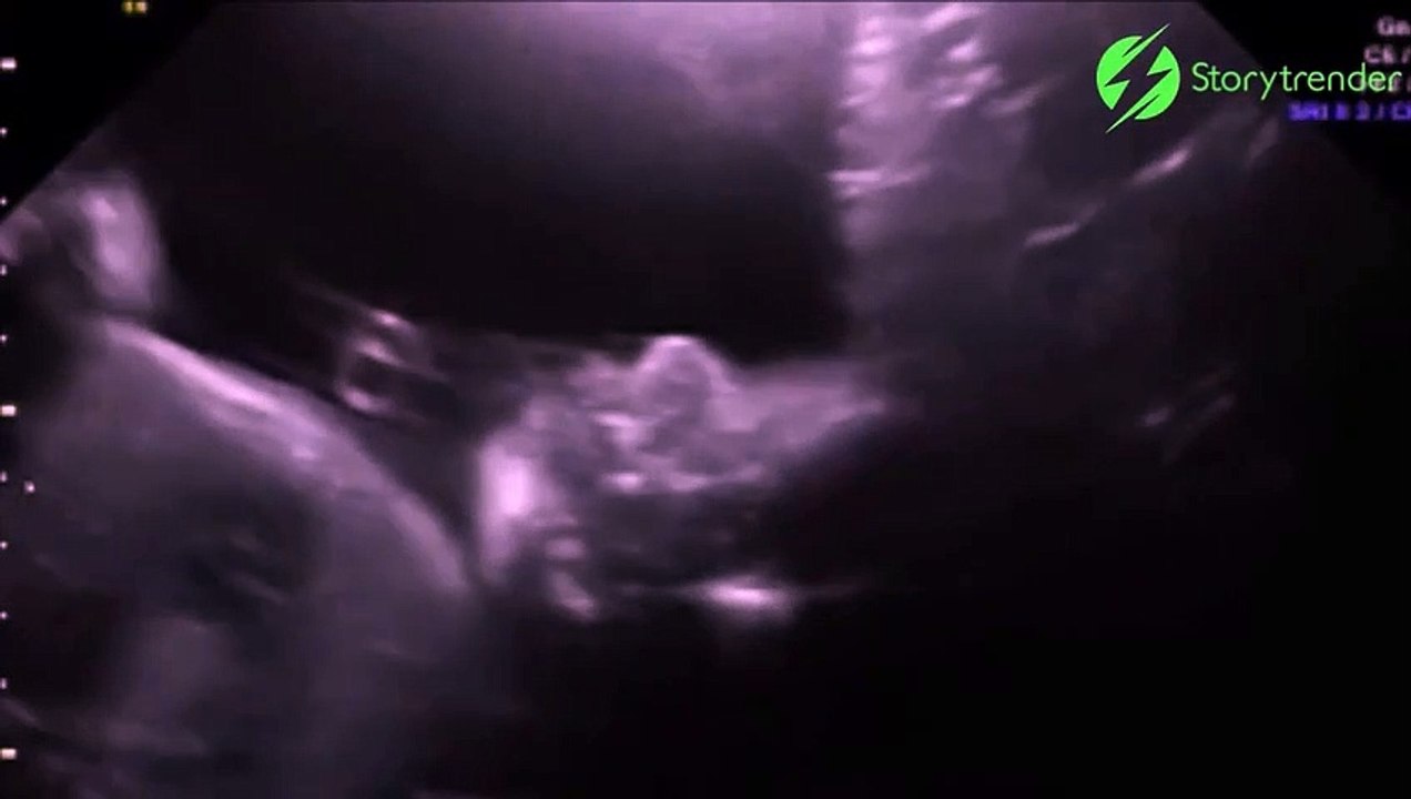 Dans le ventre de maman, ce bébé fait coucou