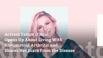 Actress Tatum O'Neal Opens Up About Living With Rheumatoid Arthritis—and Shares Her Scars From the Disease