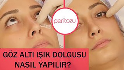 Download Video: Göz Altı Işık Dolgusu | Peri Tozu