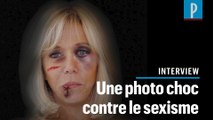 Ses œuvres montrent Brigitte Macron et Michelle Obama blessées : l'artiste s'explique