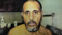 الجزيرة تحصل على صور لآثار تعذيب إسرائيل أحد الأسرى الفلسطينيين