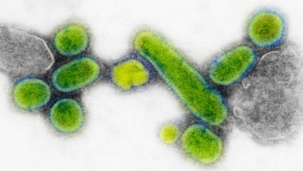 Confirmed: First Case Of Coronavirus Hits US