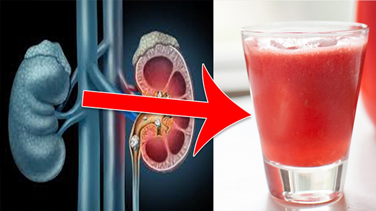 कुछ घंटो में घर पर ही kidney की सारी गंदगी को बाहर निकाले | How To Clean Kidney At Home | Boldsky
