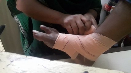 Figure of eight technique for binding crepe bandage /how to bind crepe