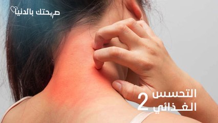 ما هو الفرق بين "التحسس الغذائي" و"عدم التحمّل الغذائي"؟ - صحتك بالدنيا