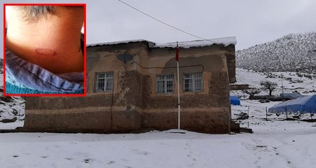 Öğrencilerin vücuduna sıcak soba maşası değdiren öğretmen açığa alındı