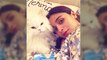 Gangubai Kathiawadi Actress Alia Bhatt Hurts Her Back; Little Kitty Eddie Gives A Health Update