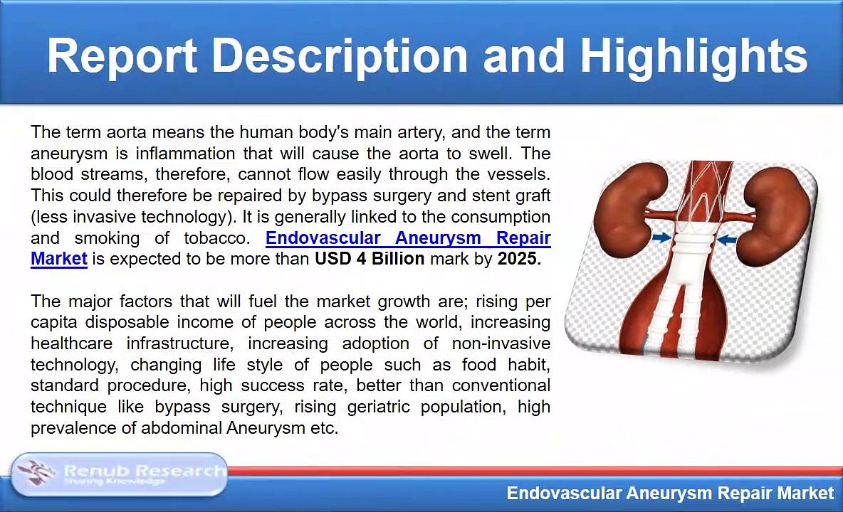 Endovascular Aneurysm Repair Market will be USD 4 Billion by 2025