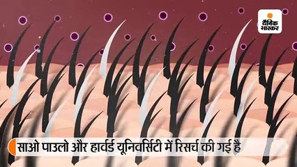 सफेद हो रहे बालों का कारण तनाव