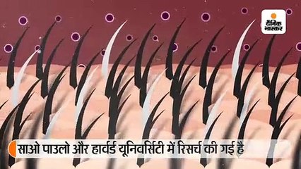 सफेद हो रहे बालों का कारण तनाव