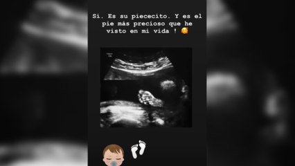 Lorena Gómez comparte con sus seguidores la ecografía de su bebé