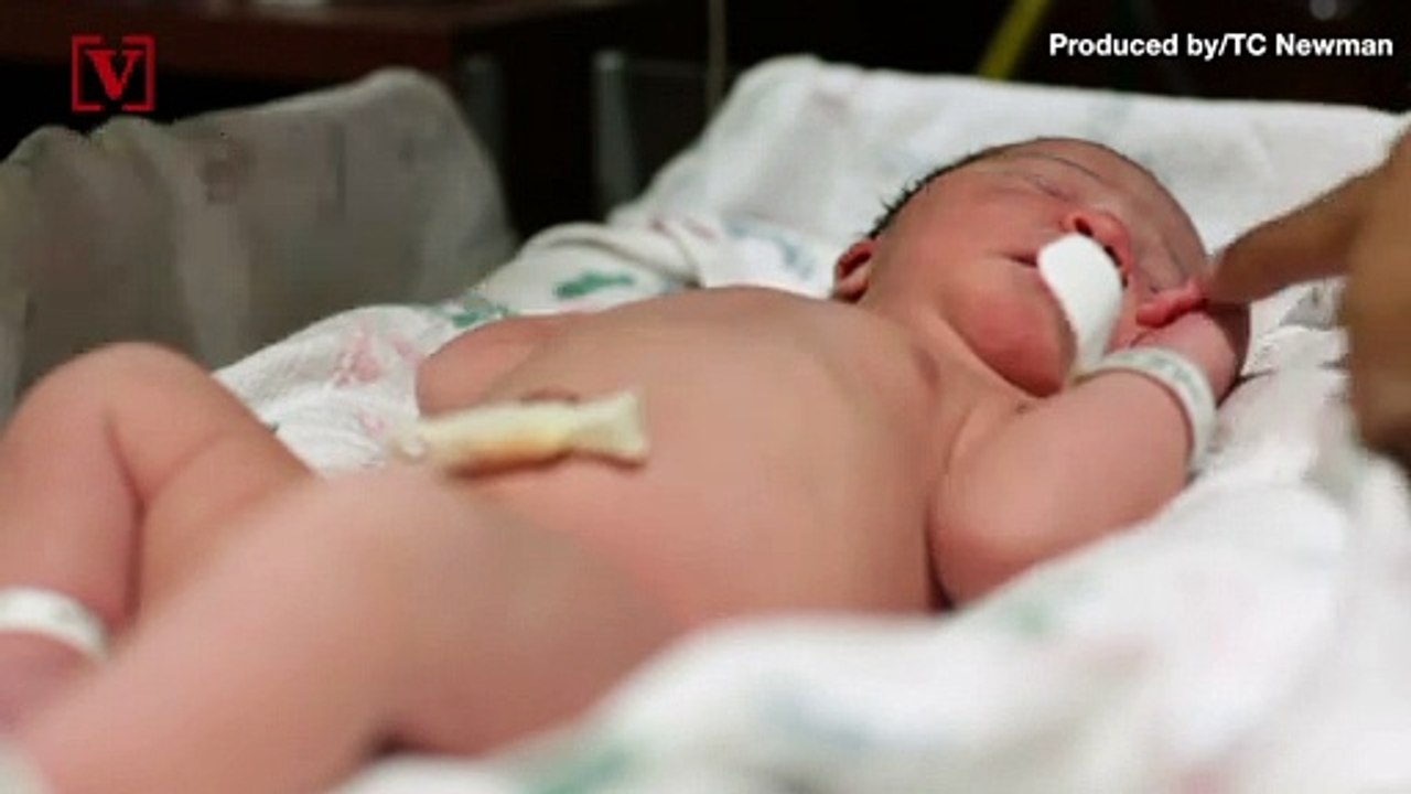 Skin-to-Skin Contact Does Not Help Bonding Betw...