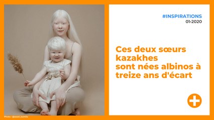 Ces deux sœurs kazakhes sont nées albinos à treize ans d'écart