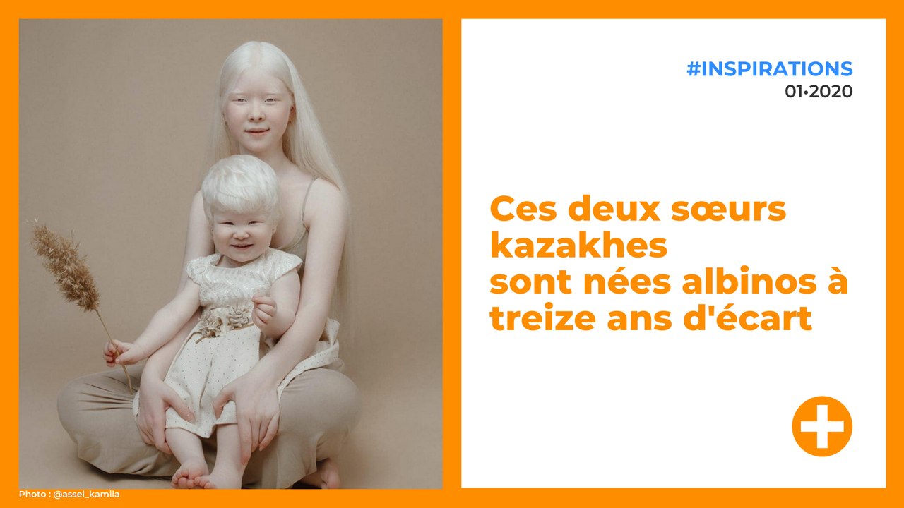 Ces deux sœurs kazakhes sont nées albinos à treize ans d'écart