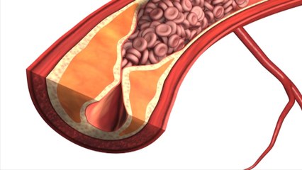 bd-presion-arterial-periferica-270120