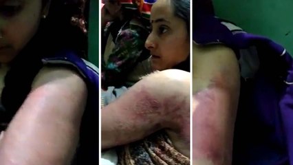 मंडीः शादी की पहली सालगिरह पर पति ने दिया ऐसा खौफनाक तोहफा, जिंदगी भर का दे गया घाव