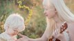 Ces deux sœurs nées albinos, de 12 ans d'écart, surprennent de par leur beauté