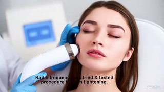 Things to Know About Radio Frequency Treatment for Tightening Skin