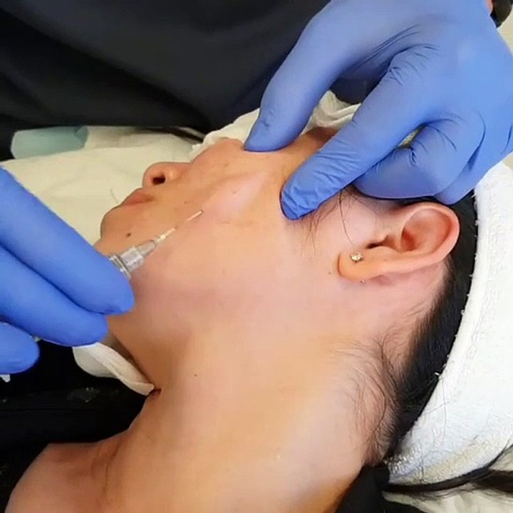 https://biomeddermalfillers.com/