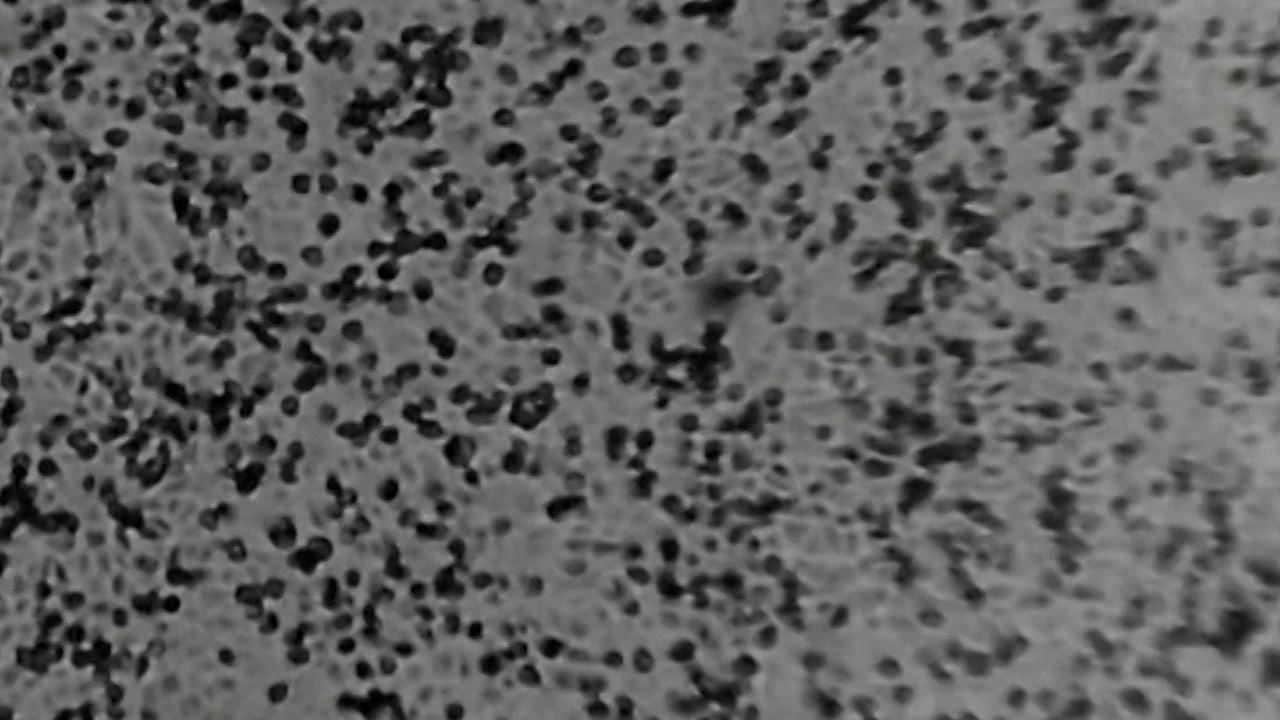Scientists in Australia first outside of China to recreate coronavirus for vaccine