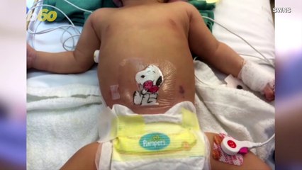 Pediatric Surgeon Makes Kids Smile With Custom Cartoon Bandages to Cover Their Scars