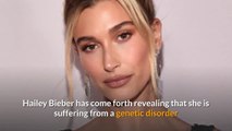 Hailey Bieber reveals having a genetic disorder, tells fans to ‘stop roasting her’