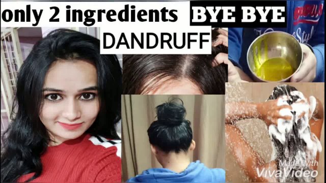 क्या आप भी परेशान है डेन्डरफ से तो ये घरेलू उपचार जरूर करे और कुछ ही दिनो में फरक देखे|| 100% Results|| Homemade natural hair care treatment || Hair care routine