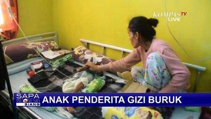 Anak Usia 3 Tahun di Baubau Menderita Gizi Buruk