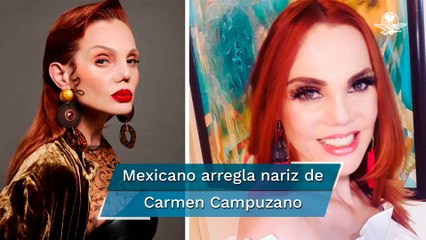 Carmen Campuzano presume su nueva nariz, reconstruida por un mexicano