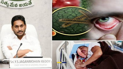 Black Fungus An 'Epidemic'- మహమ్మారిగా బ్లాక్ ఫంగస్‌.. AP లో Aarogyasri పరిధిలోకి.!!|Oneindia Telugu