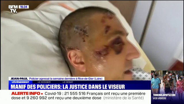 Si rien n'est fait, ce sera un autre policier ou un citoyen à ma place : le policier agressé à Rive-de-Gier témoigne