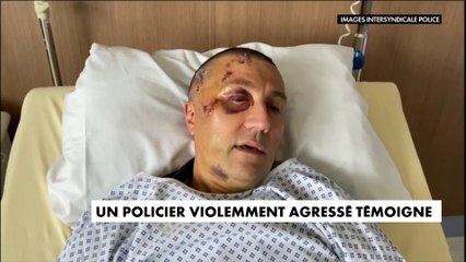 Le témoignage choc d'un policier violemment agressé