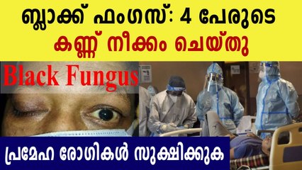 Black FUngus reasons for getting the disease | Oneindia Malayalam
