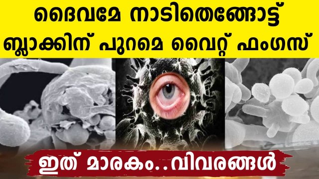 After black fungus, white fungus infection cases reported in India| Oneindia Malayalam