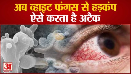 Black Fungus से खतरनाक है White Fungus, शरीर पर ऐसे करता है Attack