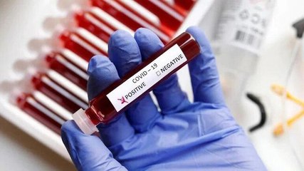 Demonstration: How to use Covid self-testing kit