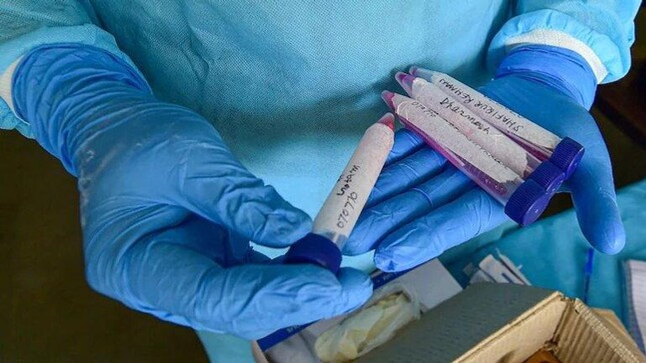 ICMR approves self-testing kits for Covid-19, will be available soon